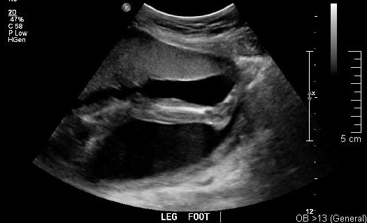 September 15 2018 image 2