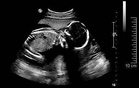 September 15 2018 image 3